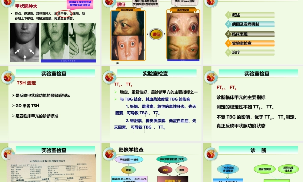 一例甲亢患者的病例讨论.ppt