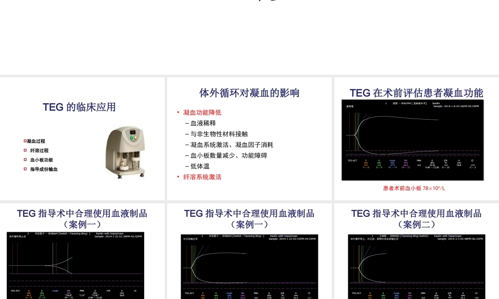 TEG在外科输血中的应用.ppt