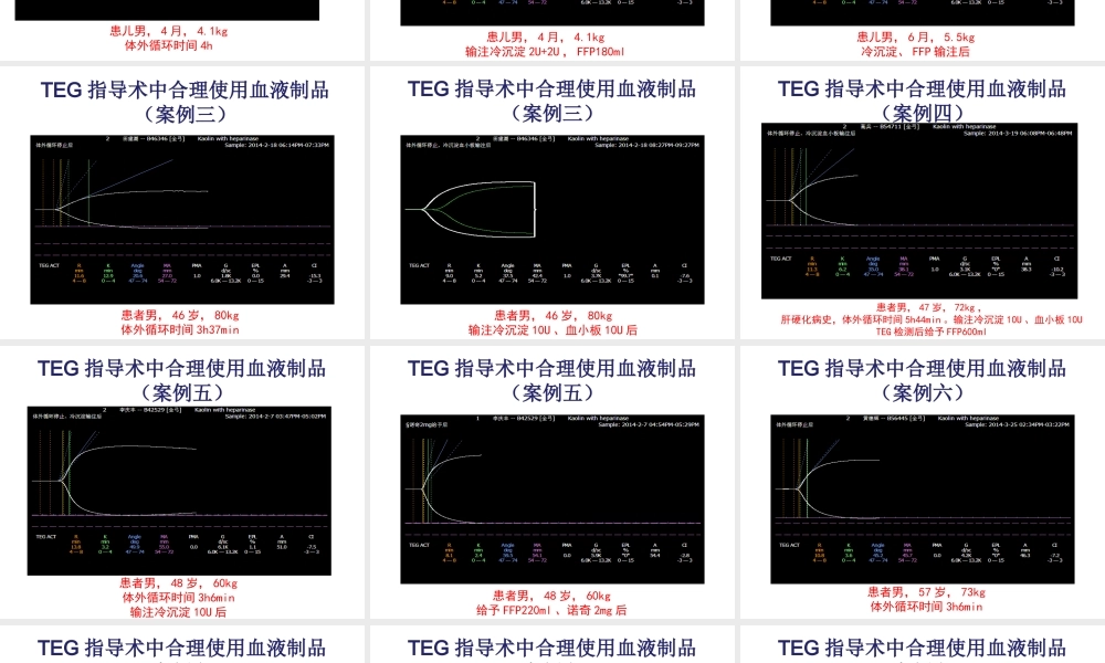 TEG在外科输血中的应用.ppt