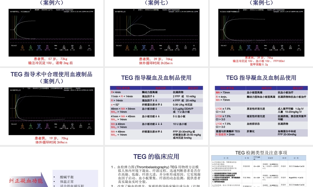 TEG在外科输血中的应用.ppt