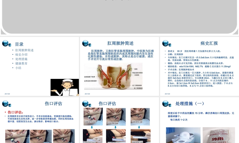 一例肛周脓肿术后换药个案.ppt