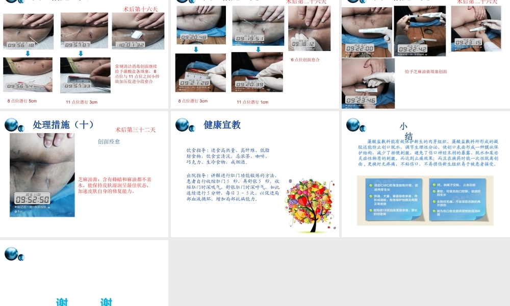 一例肛周脓肿术后换药个案.ppt