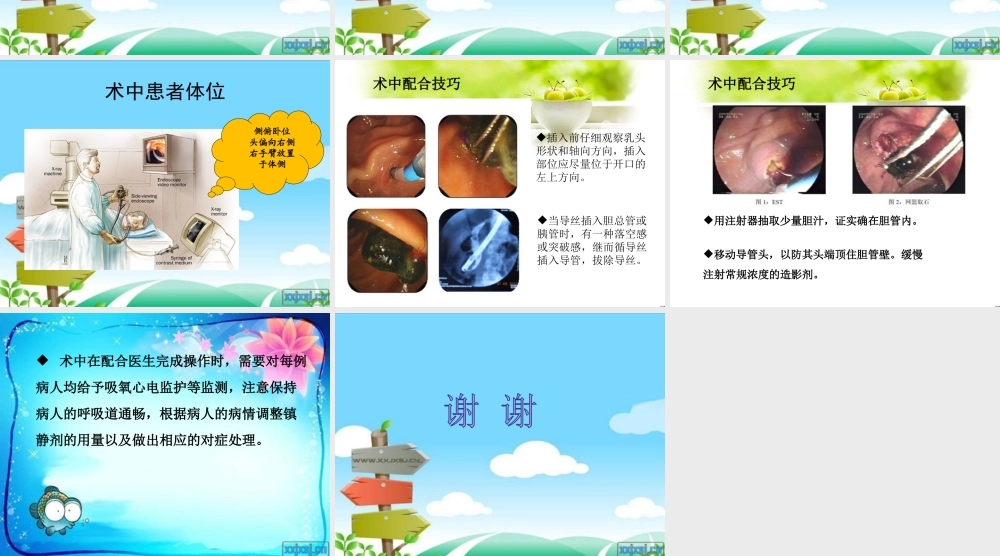 ERCP术中配合.ppt