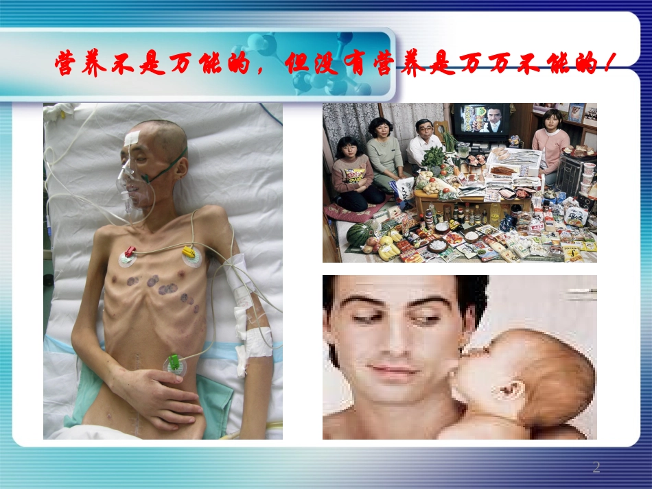 危重患者肠内与肠外营养选择.ppt_第2页