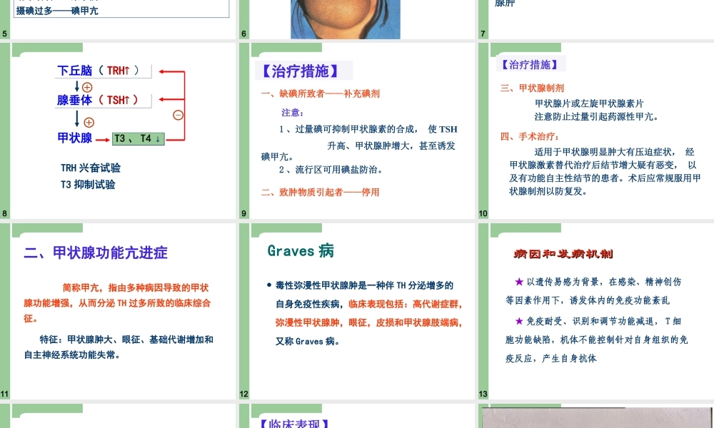 一单纯性甲状腺肿.ppt