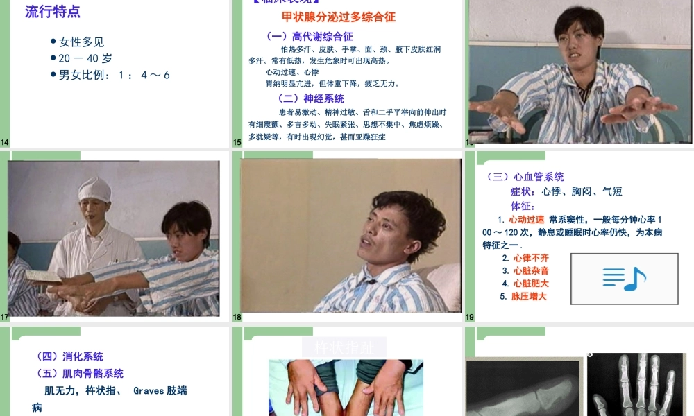 一单纯性甲状腺肿.ppt