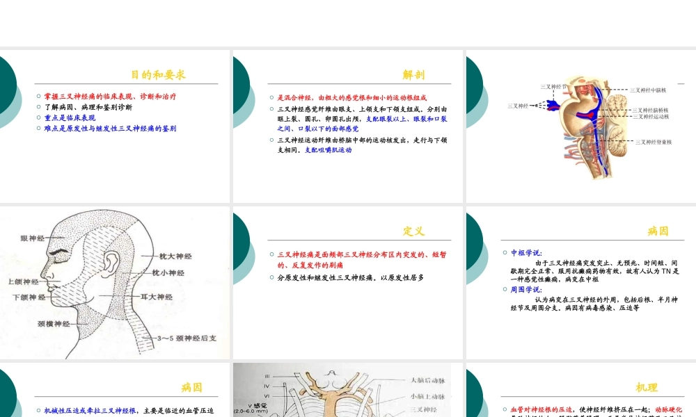 三叉神经痛.ppt.ppt