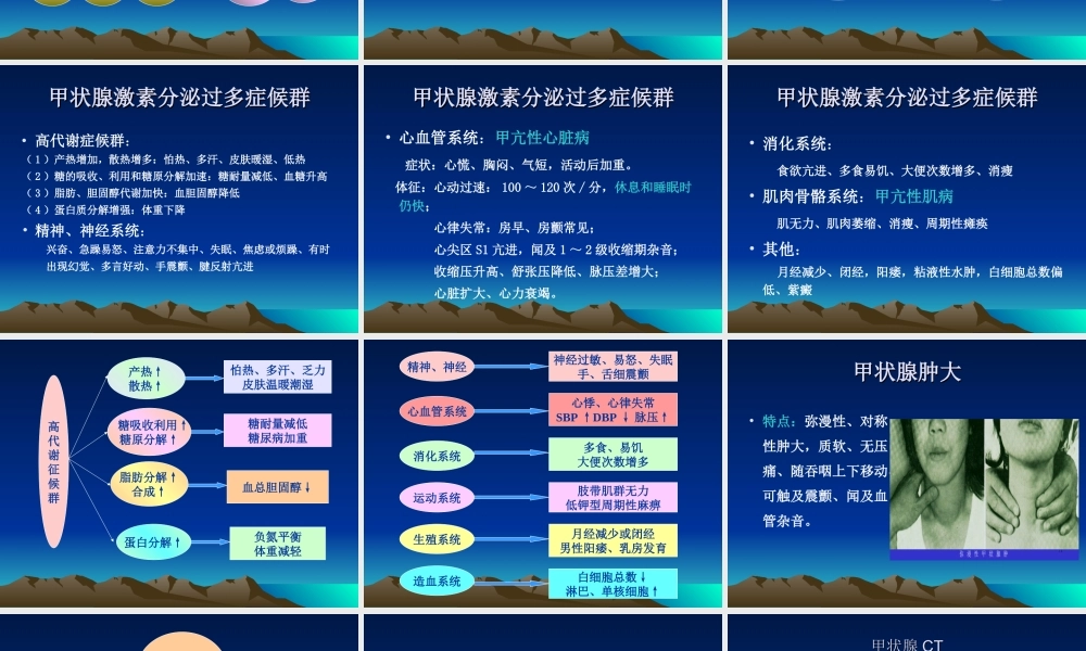 【甲亢】详解.ppt