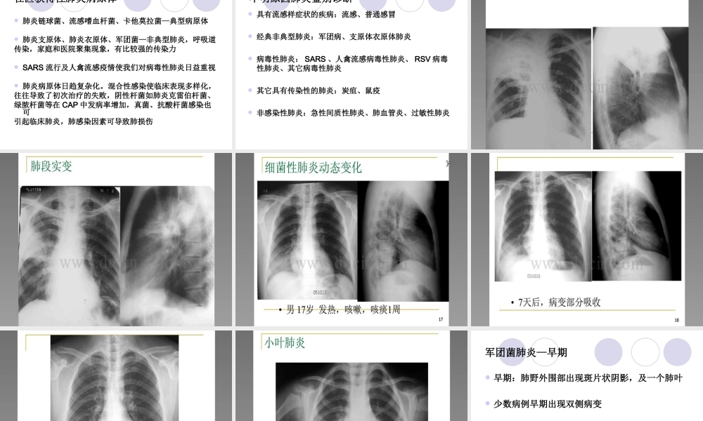 不明原因肺炎排查.ppt