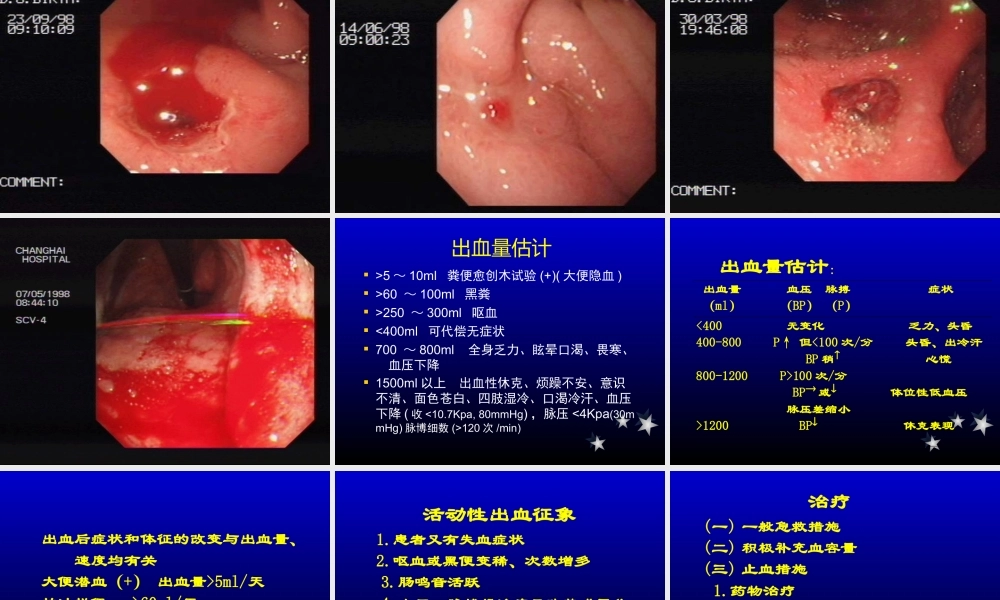 上消化道出血-zxp.ppt