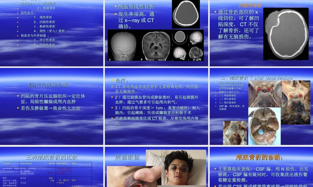 七年制课颅脑损伤.ppt
