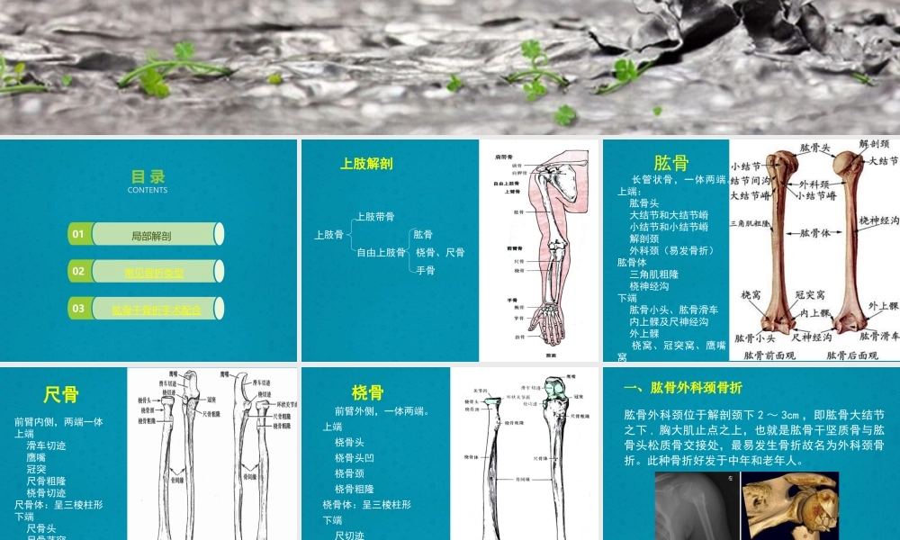 上肢骨折及手术配合.ppt
