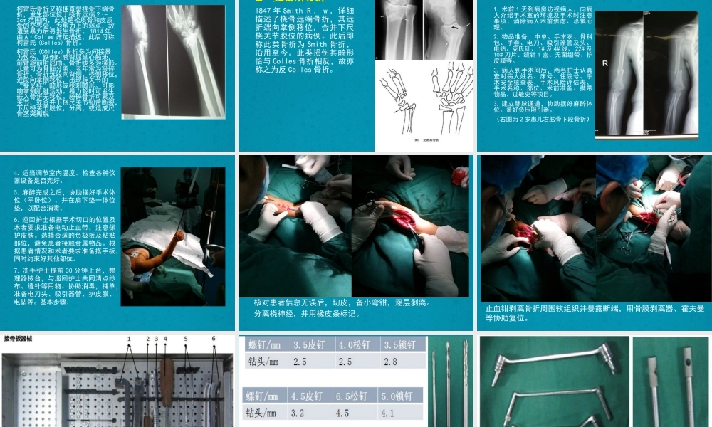 上肢骨折及手术配合.ppt