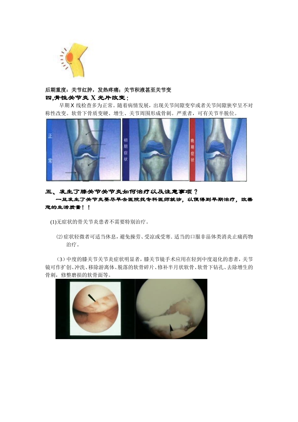 膝关节骨性关节炎的健康知识问答讲解.doc_第3页