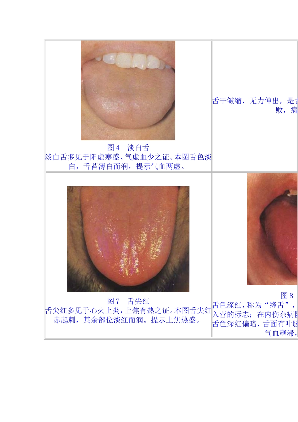 舌苔望诊图谱集.doc_第2页
