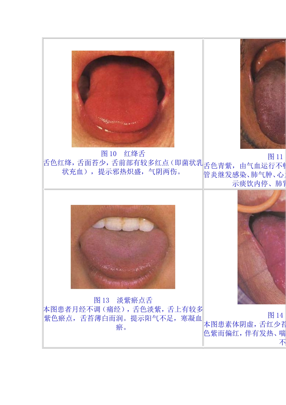 舌苔望诊图谱集.doc_第3页