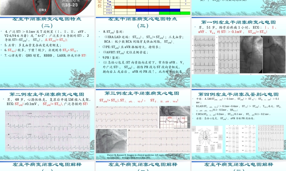 左主干病变心电图再认识.ppt