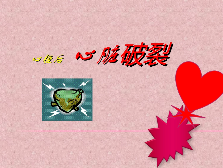 心脏破裂.ppt_第1页