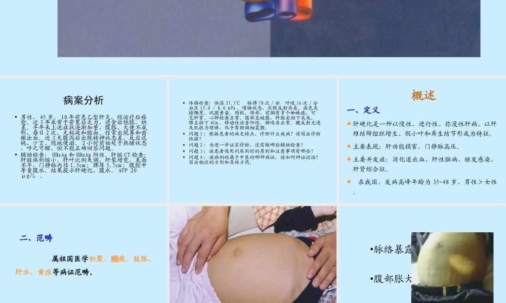 最新(2008[1].1.4职技中西医结合)肝硬化-文档资料.ppt