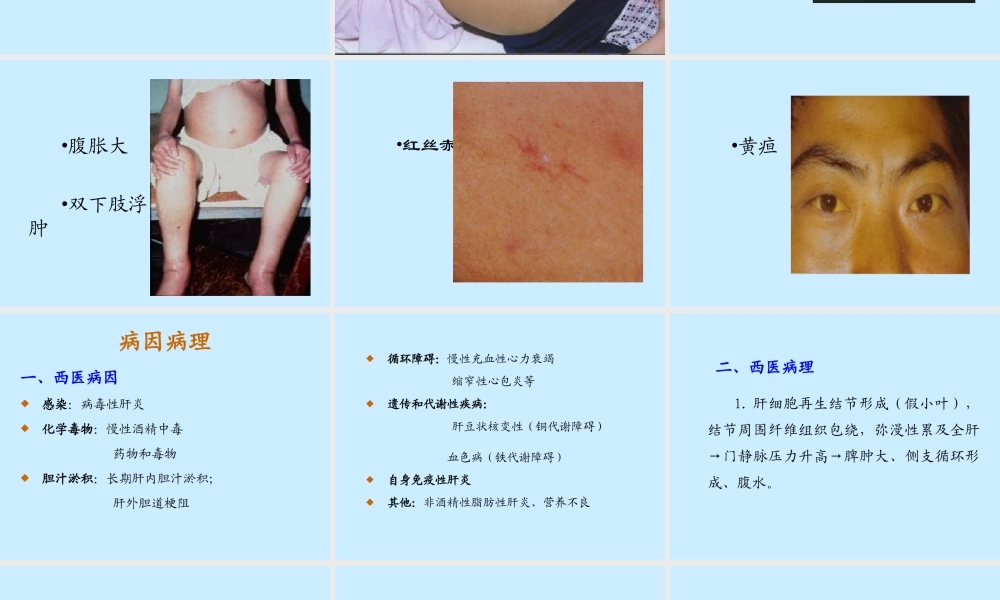 最新(2008[1].1.4职技中西医结合)肝硬化-文档资料.ppt