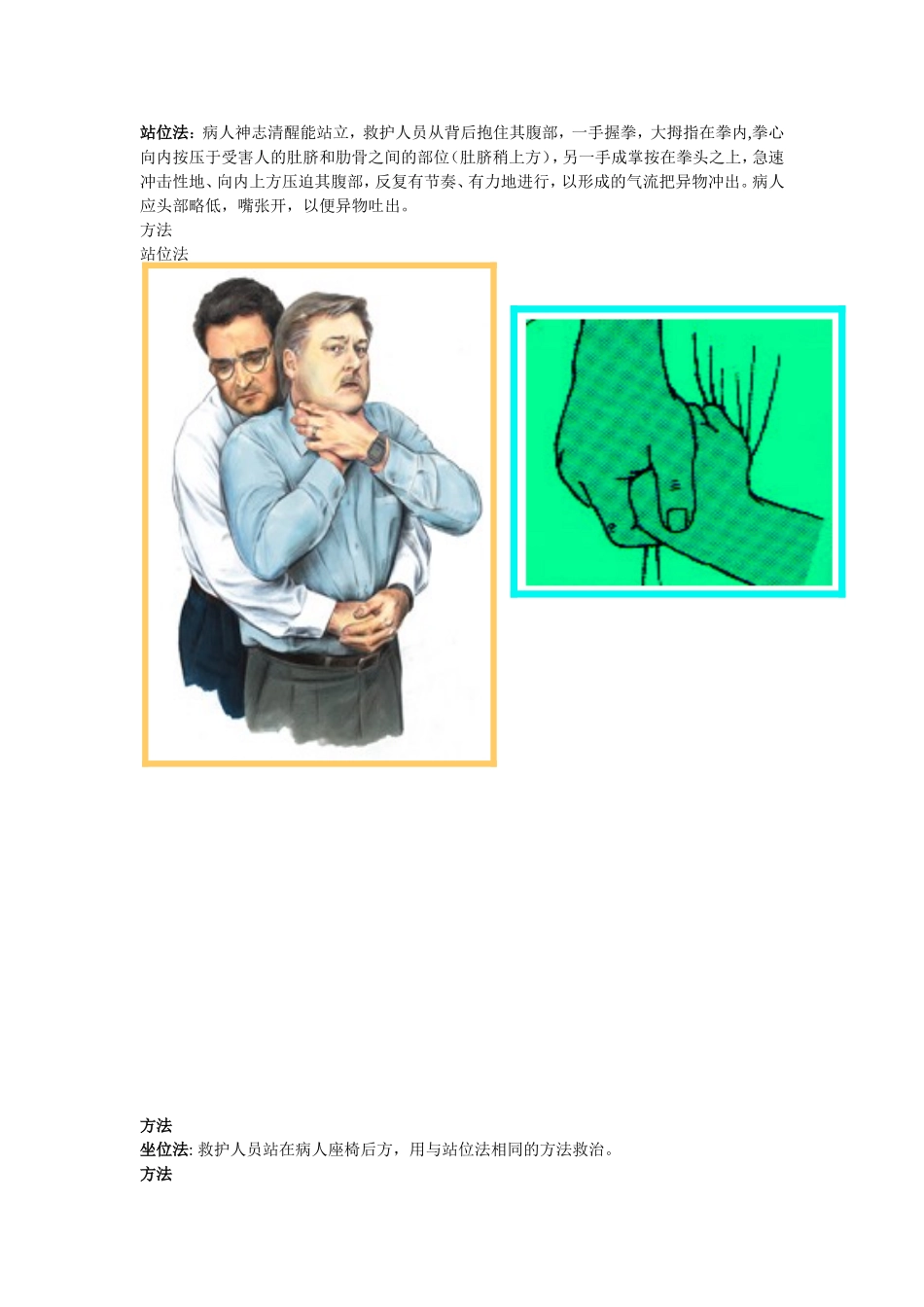 气管异物阻塞的急救.doc_第3页