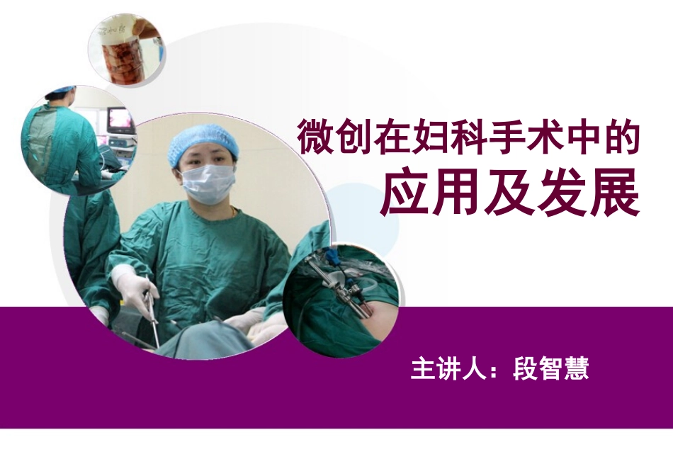 微创在妇科手术中的应用及发展.ppt_第2页