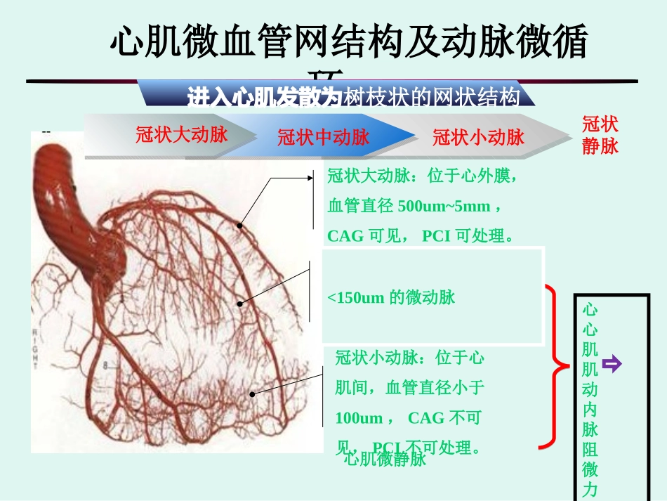 心肌微血管病变(正稿).ppt_第3页