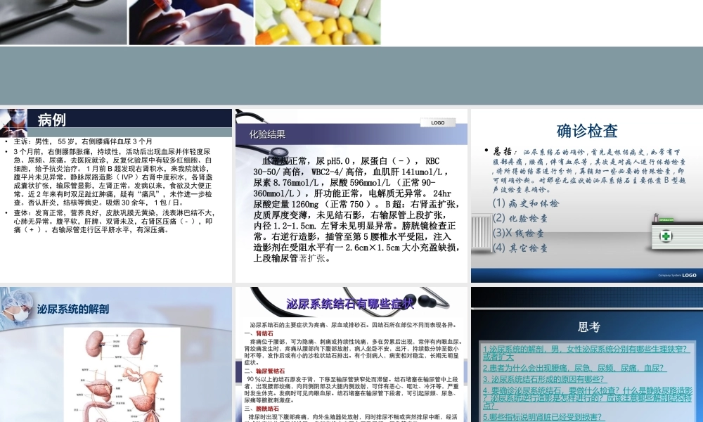 右输尿管结石病例分析.ppt123.ppt