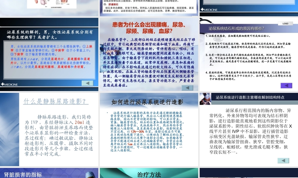 右输尿管结石病例分析.ppt123.ppt