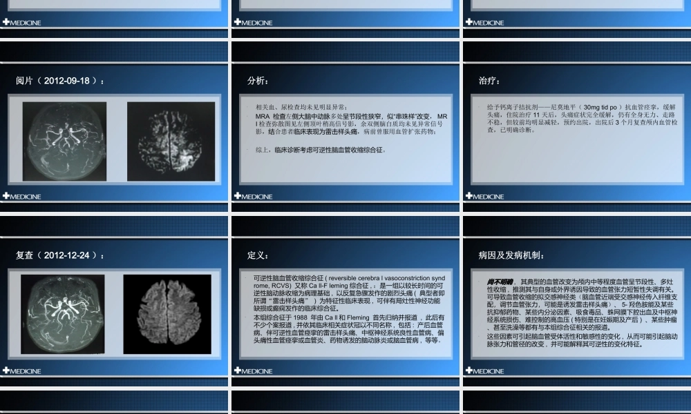 可逆性脑血管收缩综合征.ppt