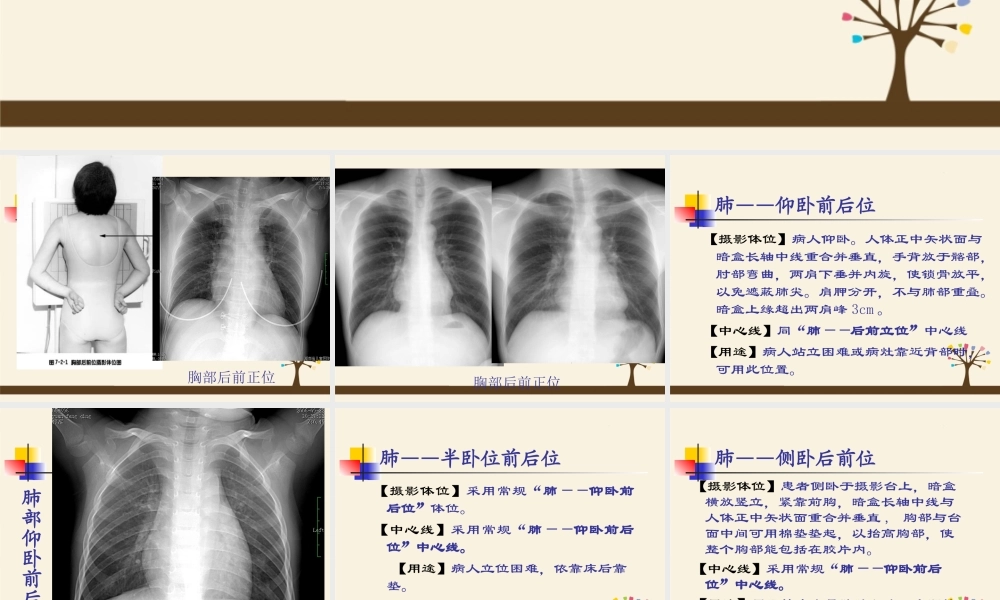 呼吸、循环、消化、泌尿影像学.ppt