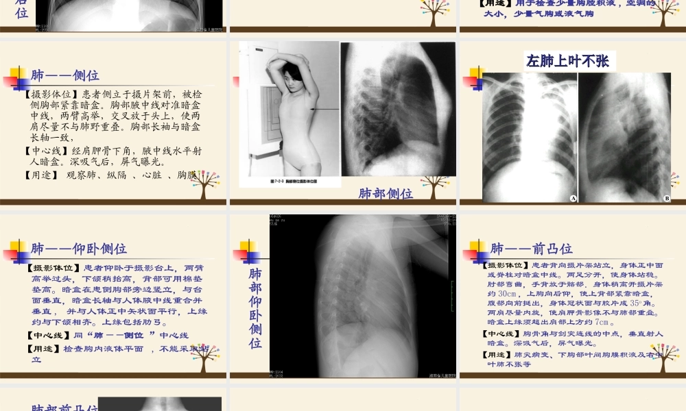 呼吸、循环、消化、泌尿影像学.ppt