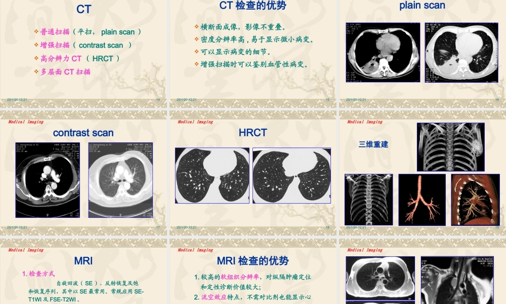 呼吸系统影像学概述.ppt