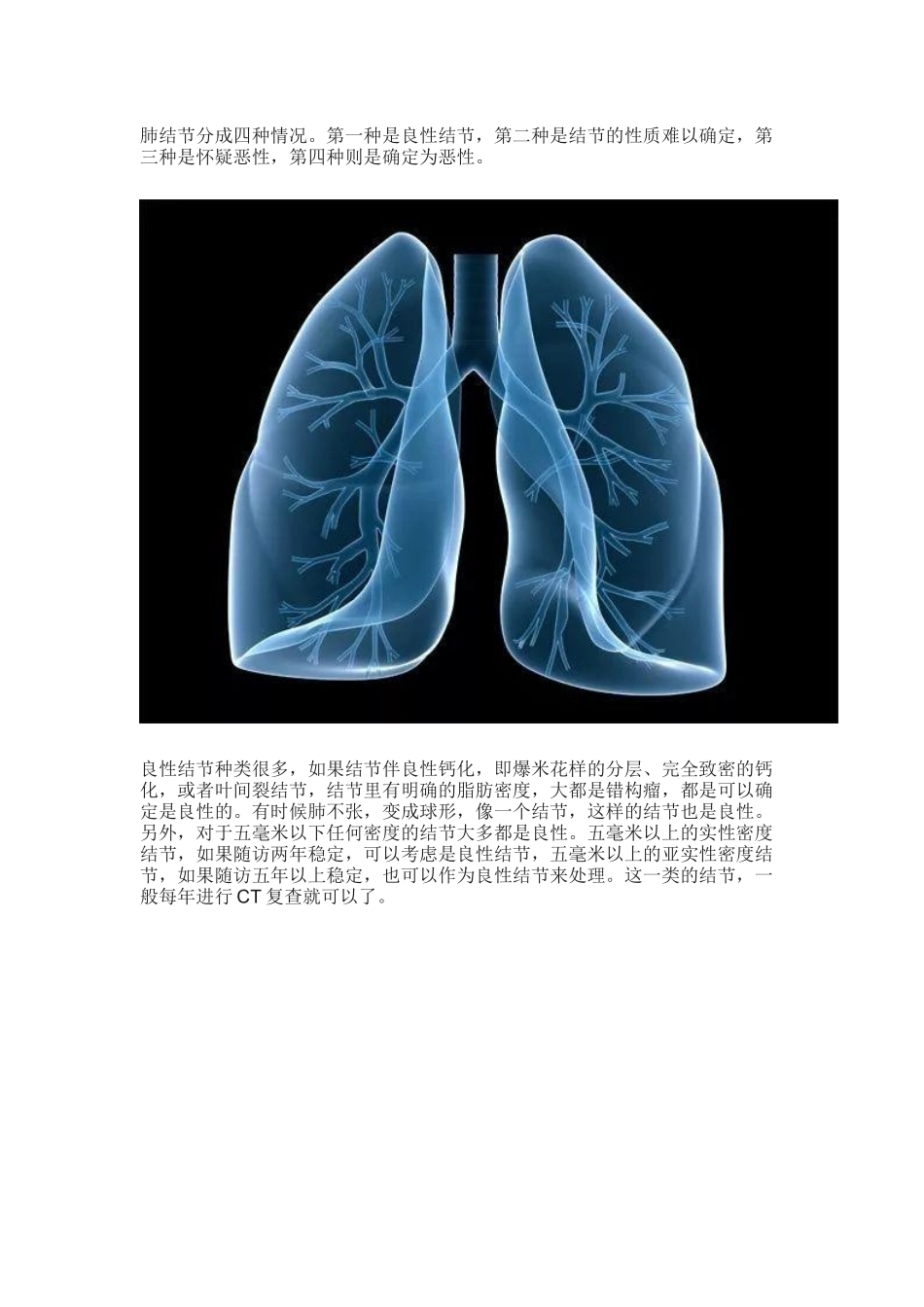 如何判断肺结节是良性还是恶性？.docx_第1页