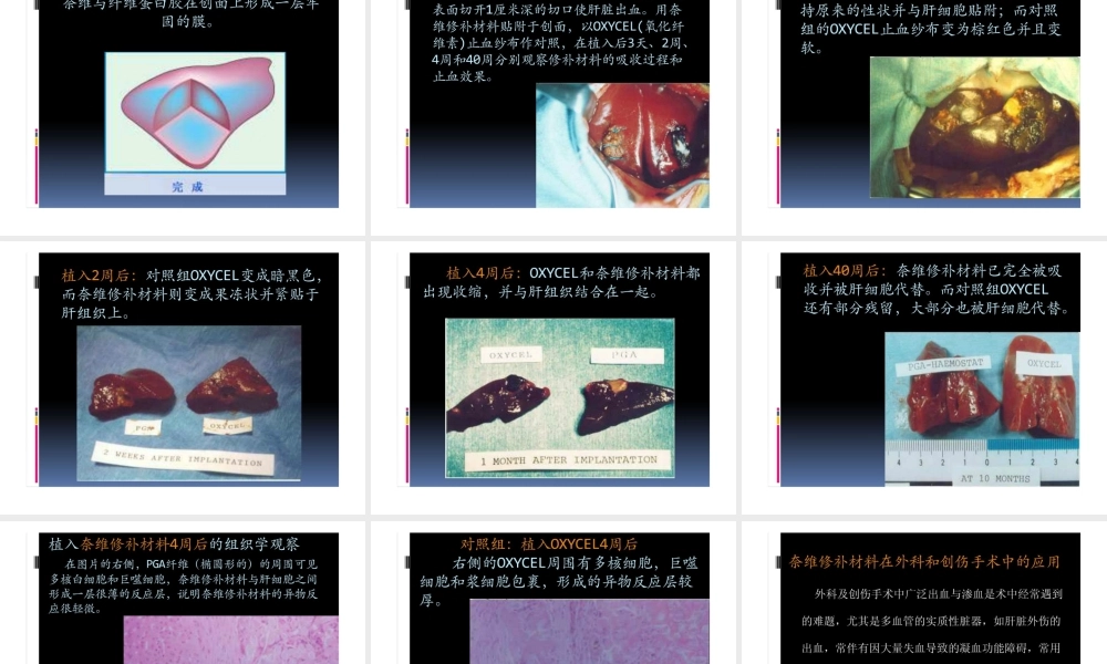 可吸收性聚乙醇酸修补材料(普外科).ppt