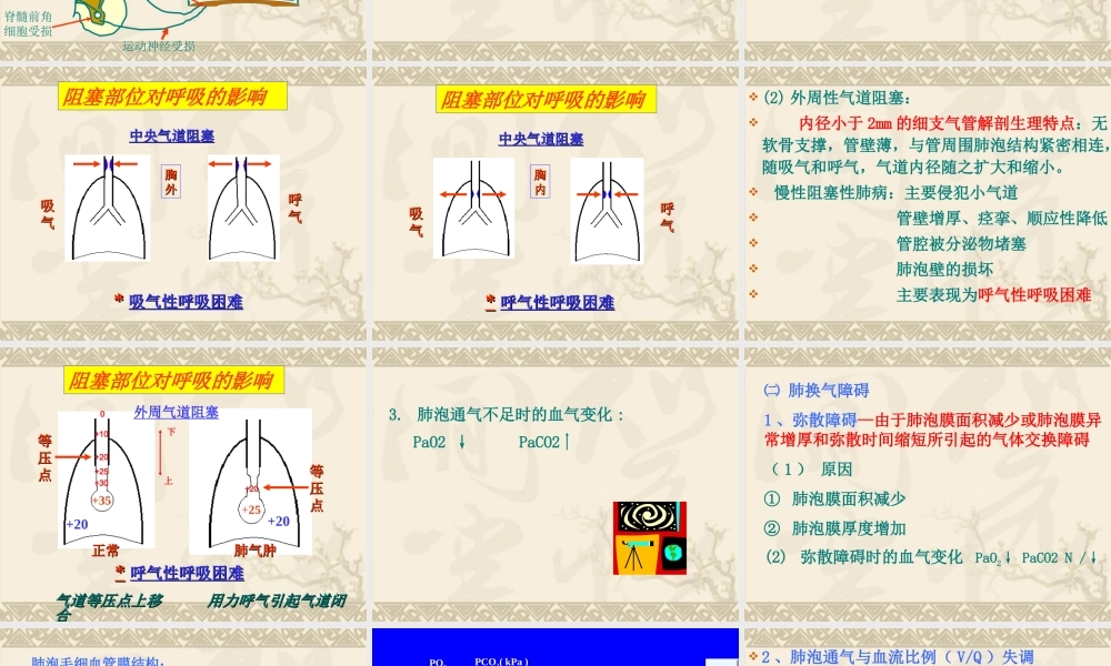 呼吸衰竭respiratoryfailure一、概述定义：外呼吸(4).ppt