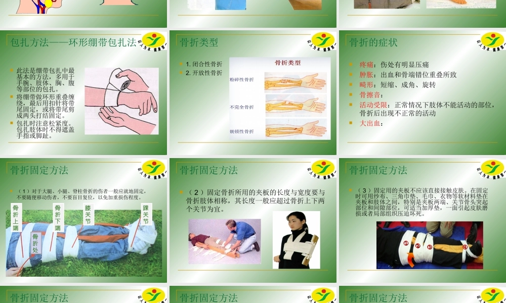 四年级急救的止血、包扎、骨折固定和搬运技术.ppt