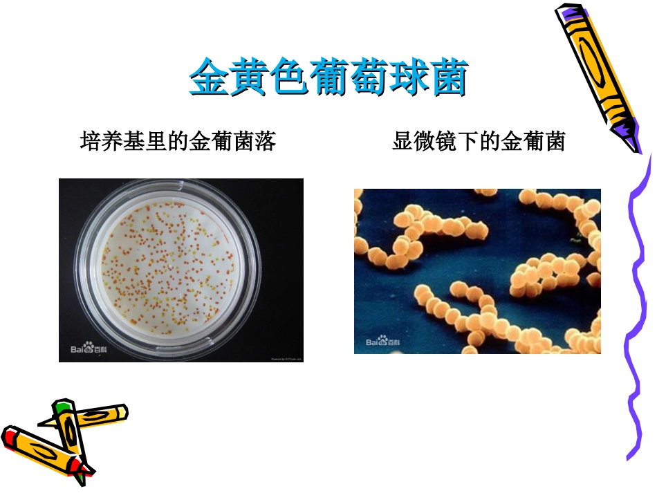 新生儿金葡菌感染.ppt_第3页