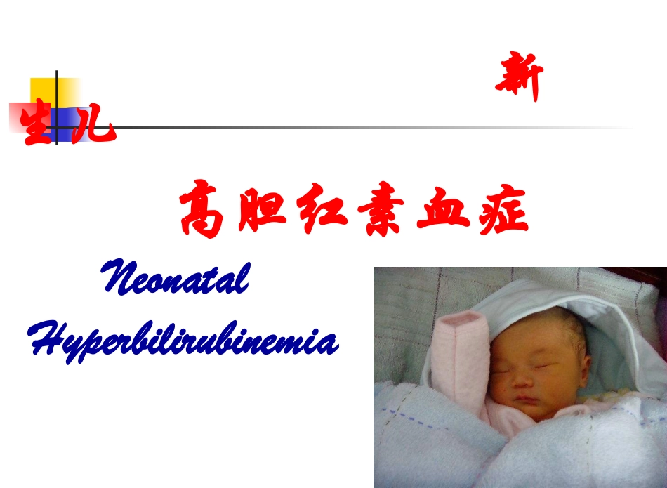 新生儿高胆红素血症剖析.ppt_第1页
