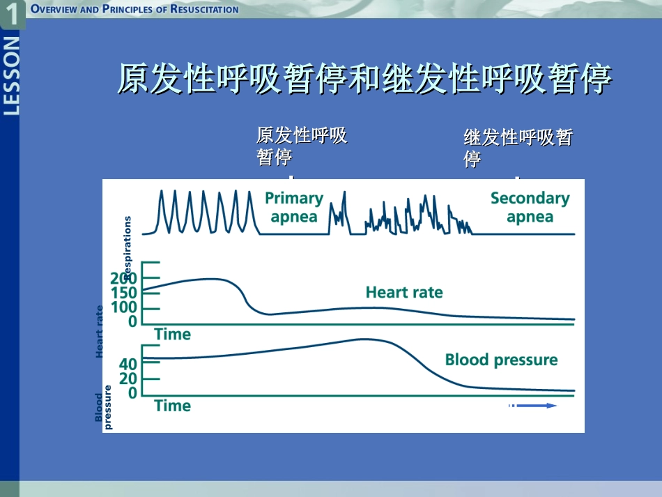 新生儿高胆红素血症新进展.ppt_第3页