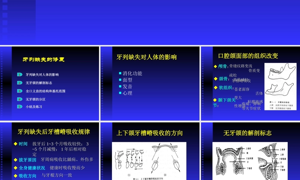 口腔修复学-第六章全口义齿修复.ppt