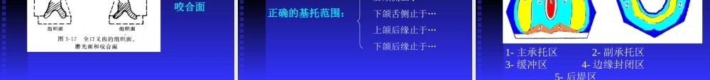 口腔修复学-第六章全口义齿修复.ppt