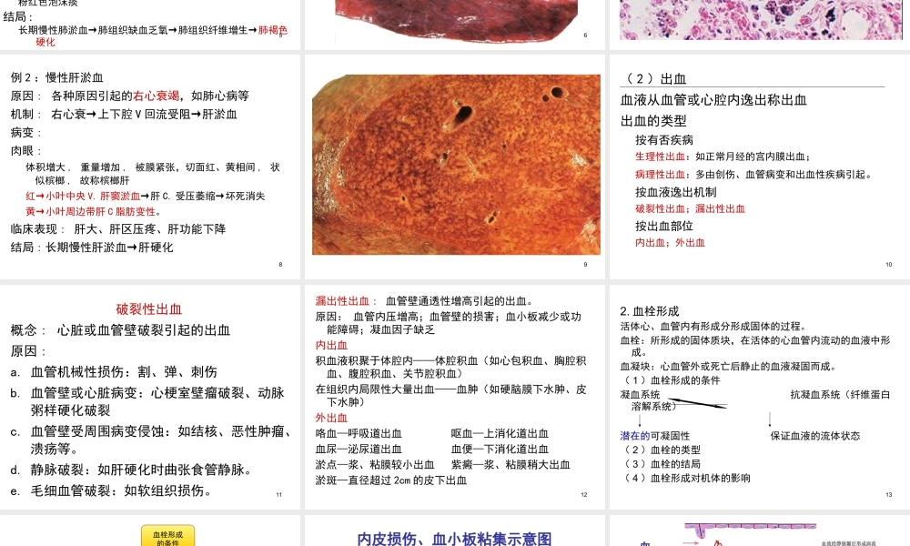 8局部血液循环障碍.ppt