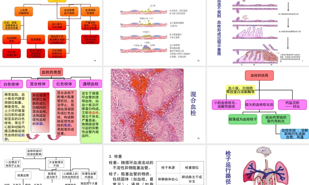 8局部血液循环障碍.ppt