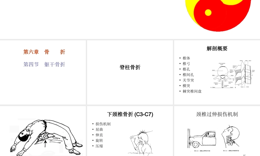 6.4第六章-第四节躯干骨折.ppt