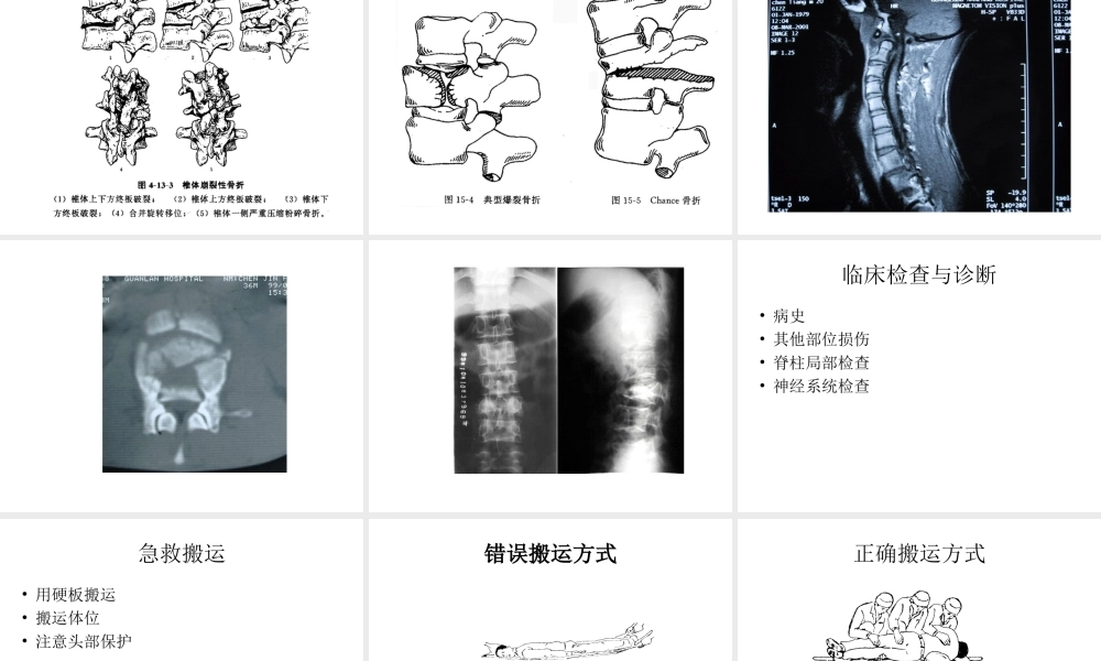 6.4第六章-第四节躯干骨折.ppt