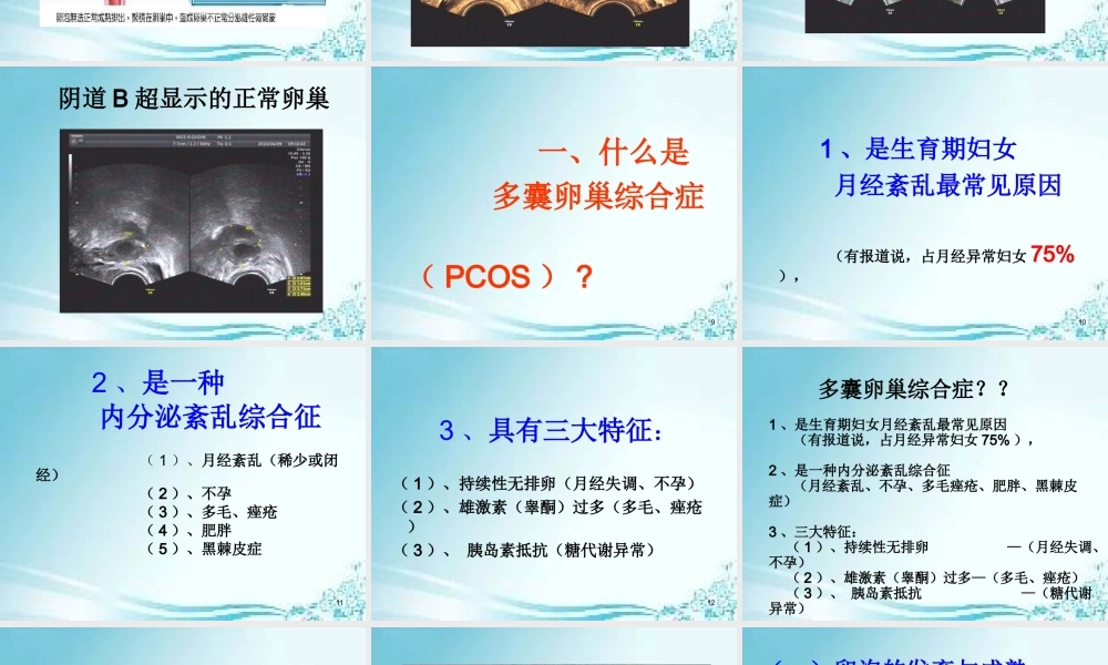 5、多囊卵巢综合症(PCOS).ppt