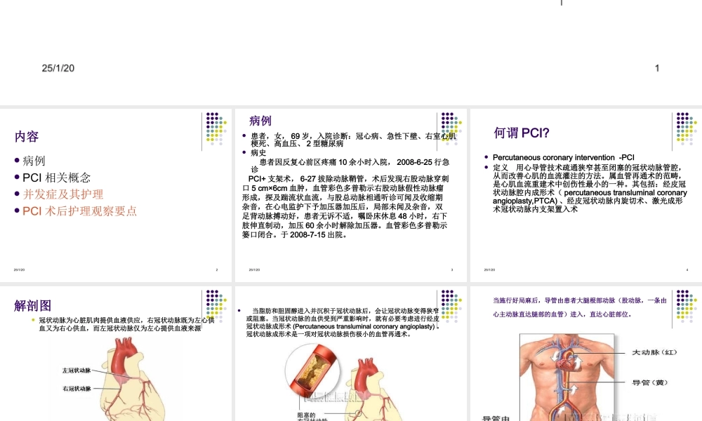 PCI术后并发症原因.ppt