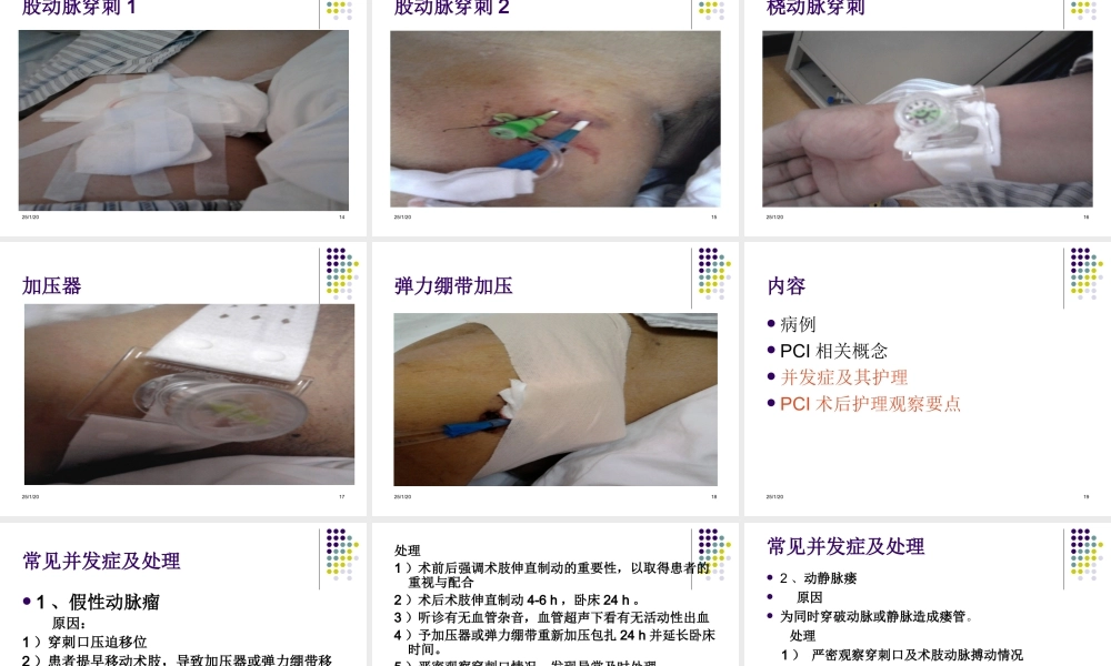 PCI术后并发症原因.ppt