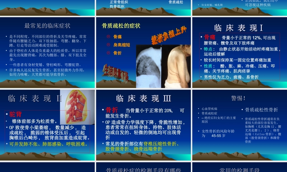 pz骨质疏松.ppt
